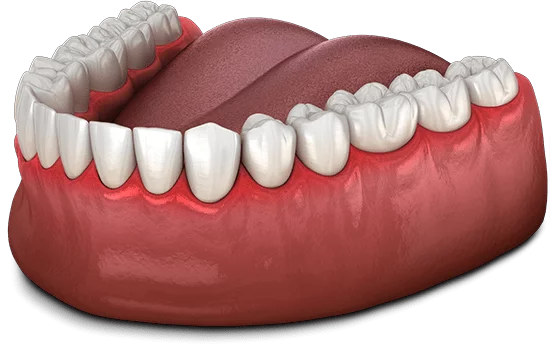 gum disease graphic